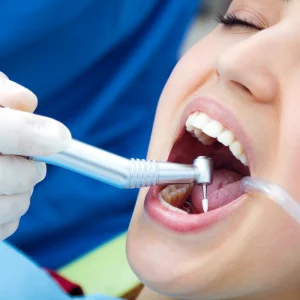 DentalPremium Oferta Limpieza Dental