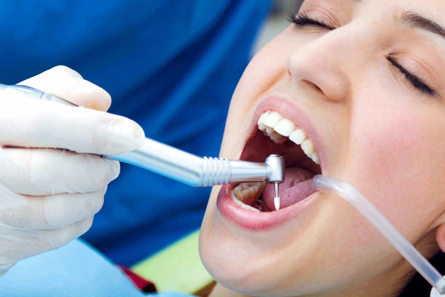 DentalPremium Oferta Limpieza Dental
