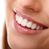 blanqueamiento-dental-en-dentalpremium