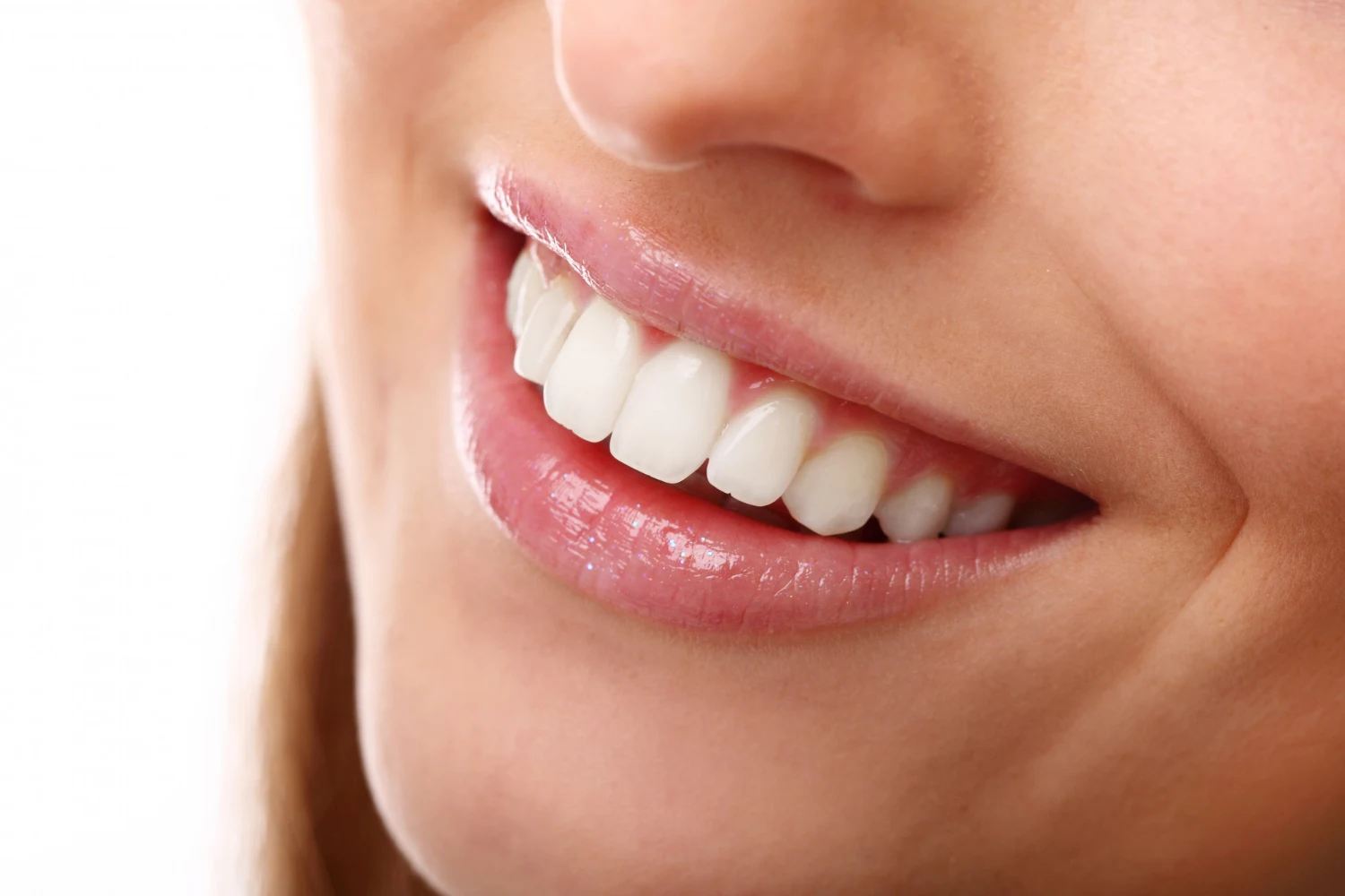 blanqueamiento-dental-en-dentalpremium