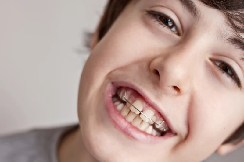 ortodoncia-interceptiva-blog-dental-dentalpremium